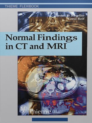 cover image of Normal Findings in CT and MRI
